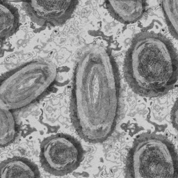 Qu'est-ce que la variole du singe ?
