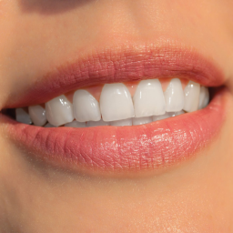 Quels sont les dangers du limage des dents ?