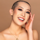 How has alopecia affected your life?