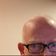 Episode 1820 Scott Adams: How Not To Get Monkeypox (It's Easier Than You Think)