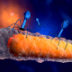 Bakteriophagen können multiresistente Bakterien ausschalten