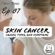 Cancer Series Ep 7:- Skin Cancer: Causes, Types, and Symptoms