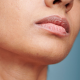 Gerçures, perlèche, herpès… comment prendre soin de ses lèvres ?